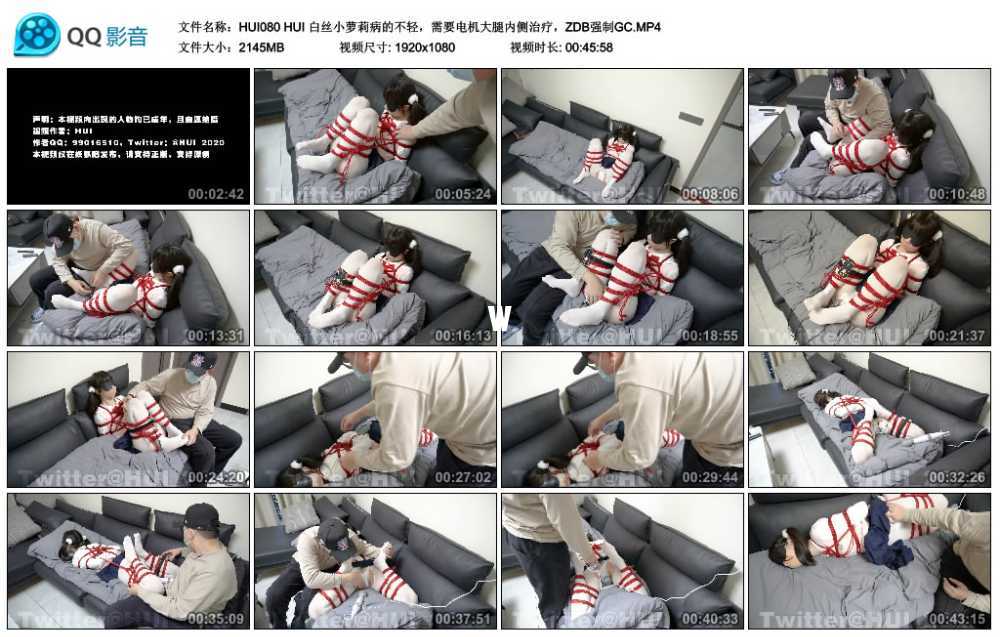 HUI 白丝小萝莉病的不轻，需要电机大腿内侧治疗，ZDB强制GC